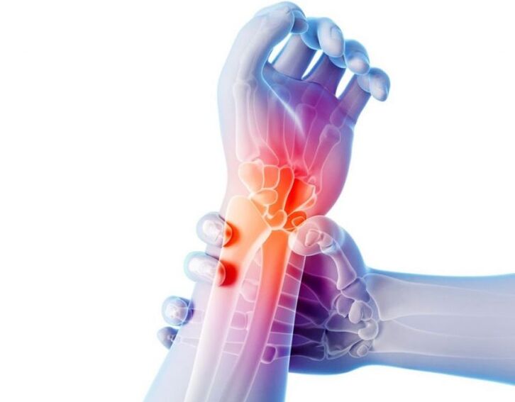 Joint arthrosis is accompanied by pain and requires complex treatment